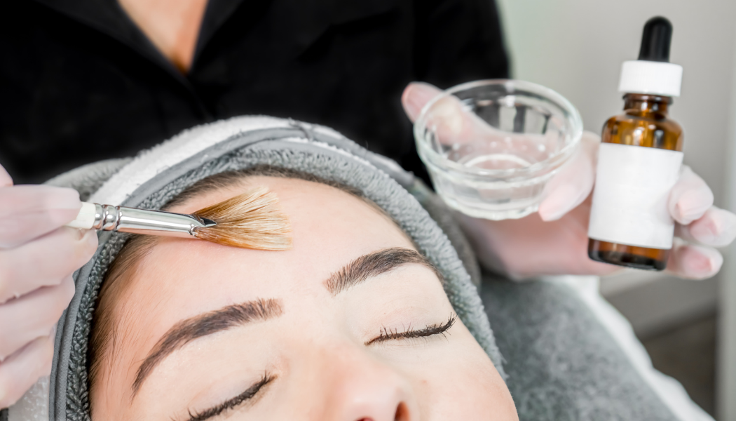 Chemical Peels
